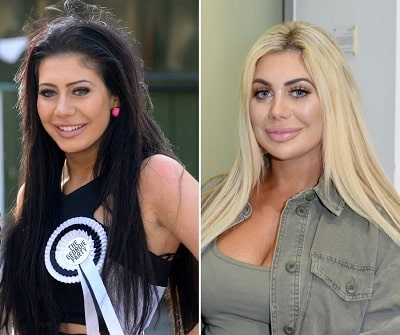 A picture of Chloe Ferry before (left) and after (right) plastic surgeries.
